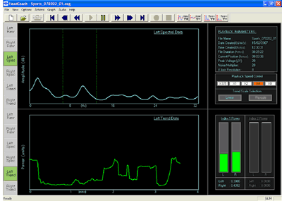 Figure 8 shows the trend in the intensity versus time (green trace). The upper display (blue trace) shows the spectrum at approximately 3.3 minutes, which corresponds to the last point in the intensity versus time trace. 